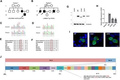 SOD1 Mutation Spectrum and Natural History of ALS Patients in a 15-Year Cohort in Southeastern China